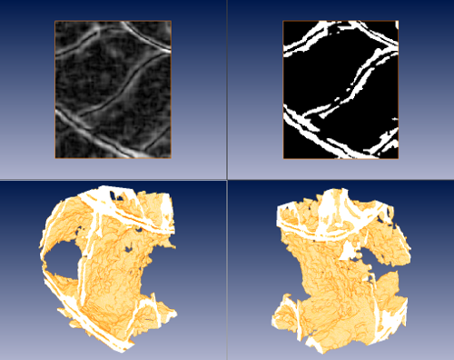 Fig. 5) Top, from left to right: result of a sobel edge detector on the denoised dataset; segmentation of septa and shell material by thresholding on the result of the edge detector. Bottom: two views of volume rendering of the previous segmentation, where portions of the septa and the siphuncle can be clearly identified.