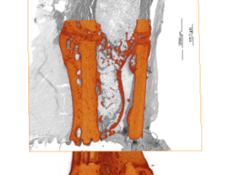 Image-based Bone Analysis