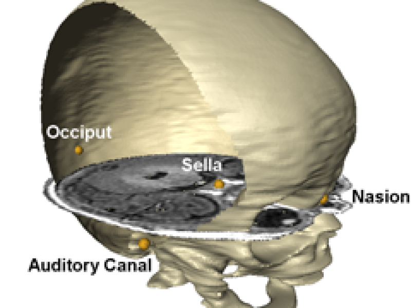 Cranial Shape Analysis