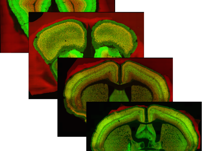 Confocal Microscopy for an Entire Mouse Brain at Cellular Resolution