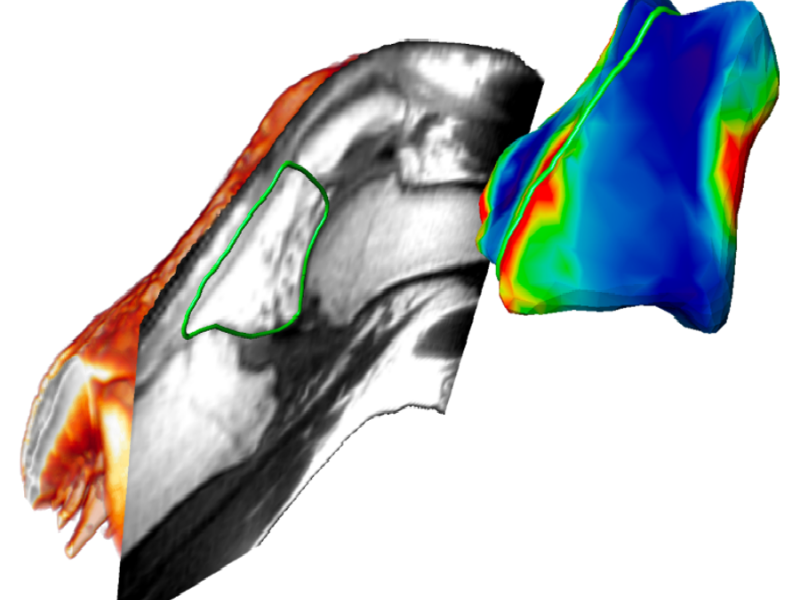 Image-based Analysis of in vivo Knee Dynamics