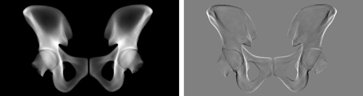 Virtual X-ray projection of mean hip (left) and its derivative w.r.t. a shape parameter (right).