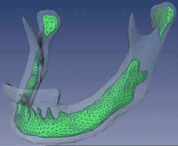 mandible1