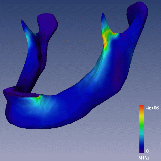 mandible7