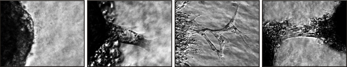 Process of Angiogenesis. Images by Andreas Benn, FU Berlin, 2014