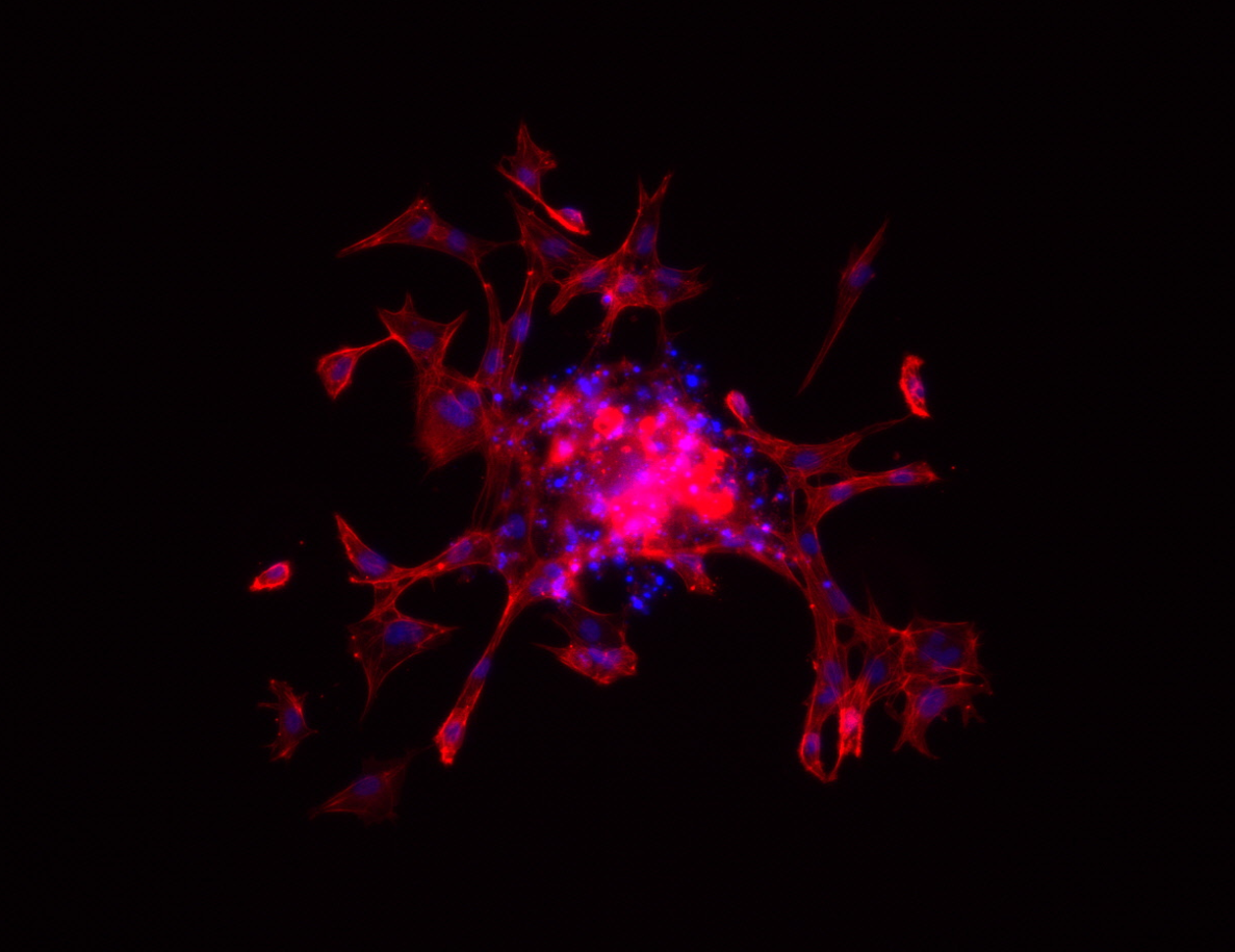 Fluorescent Sprouting Assay