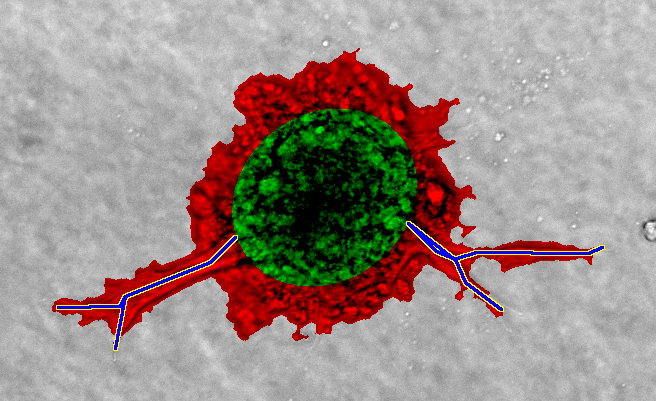 Angiogenesis Quantification