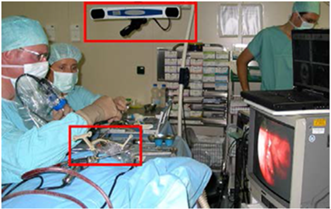 Endoscope tracking using OT