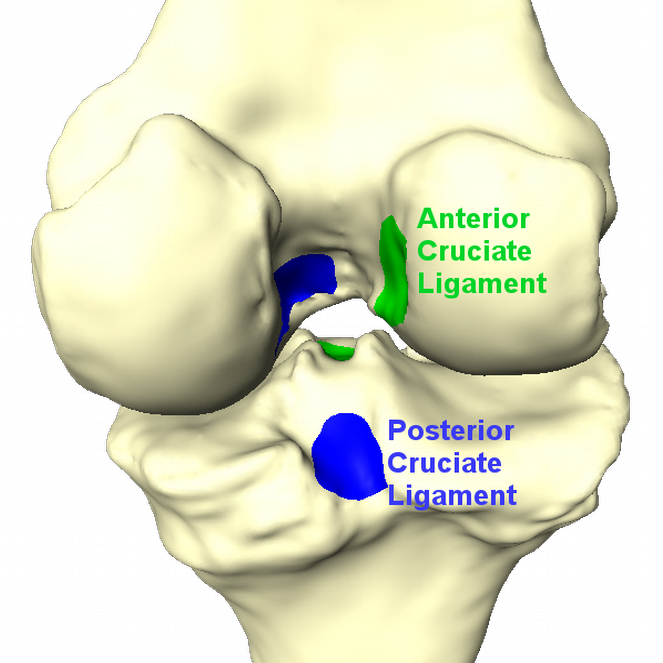 Treating Osteoarthritis in Knee with Mimicked Interpositional Spacer ...