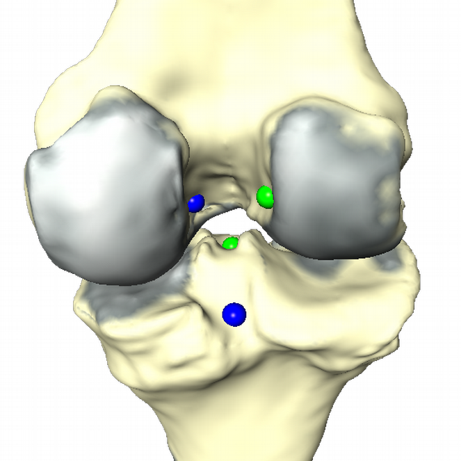 Cartilage_interface_insertion_sites