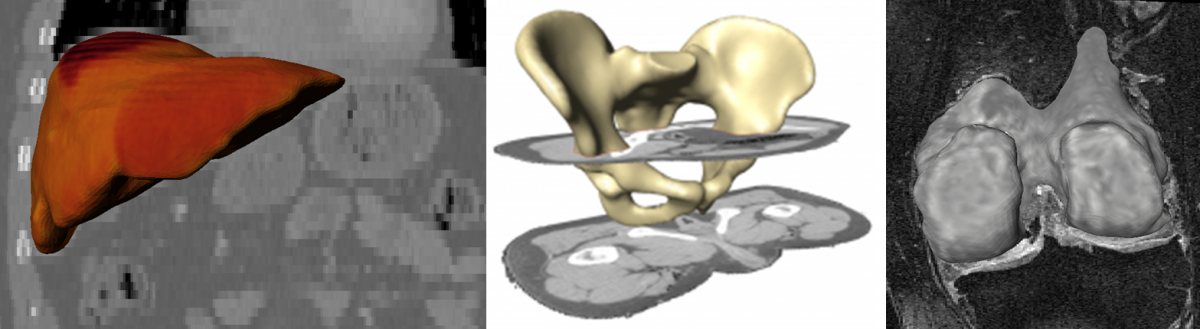 Modal General 3D Segmentation Teaser