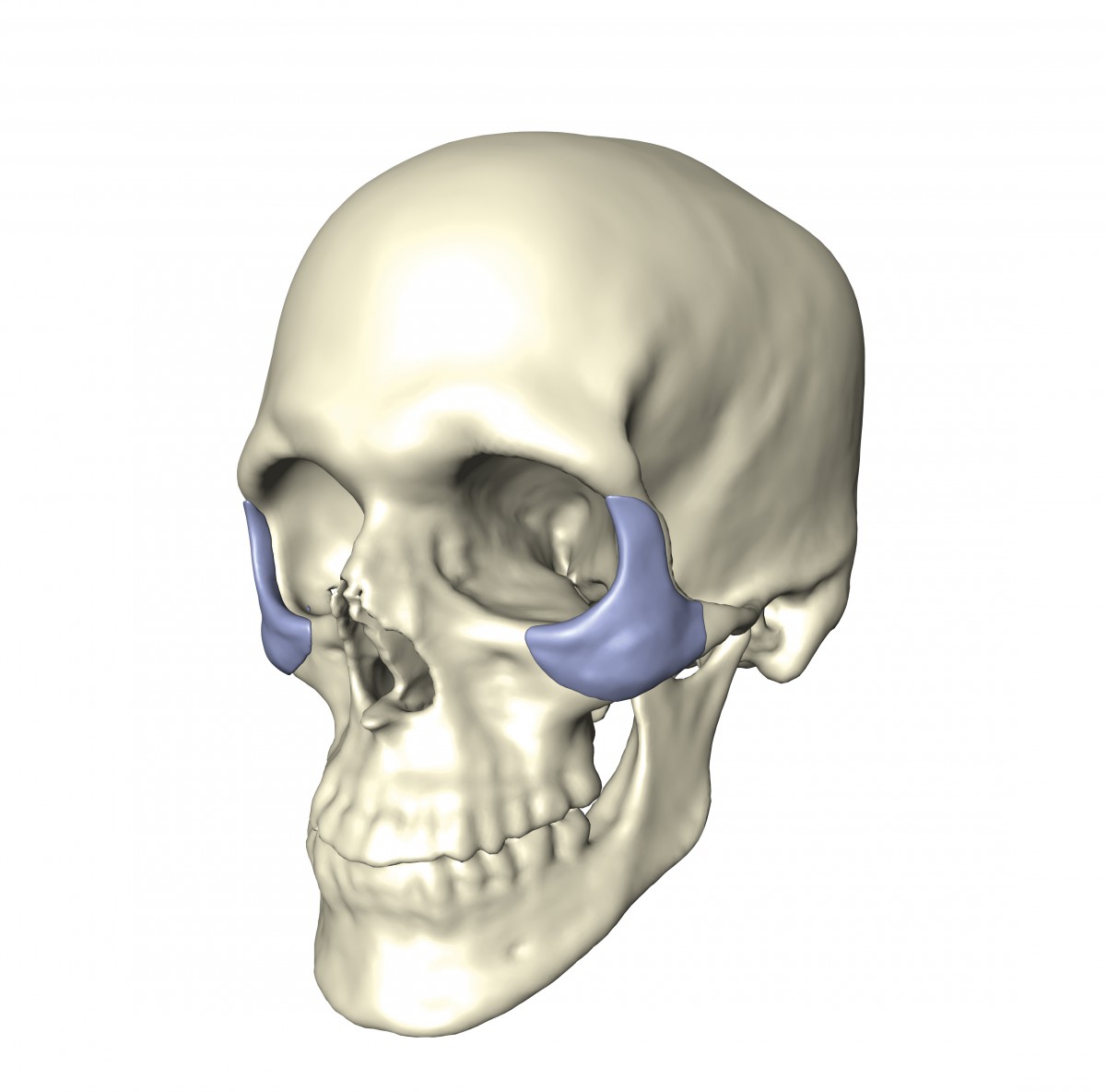 Augmentation implants replace traumatized bone or fill voids left by malformed bones. An important aspect is to restore a socially accepted facial shape, for which the appropriate implant shape has to be determined.