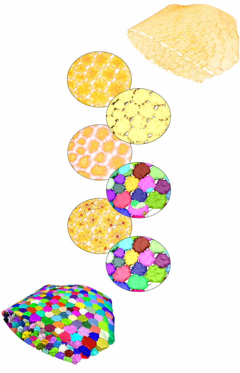 Workflow for tesserae segmentation