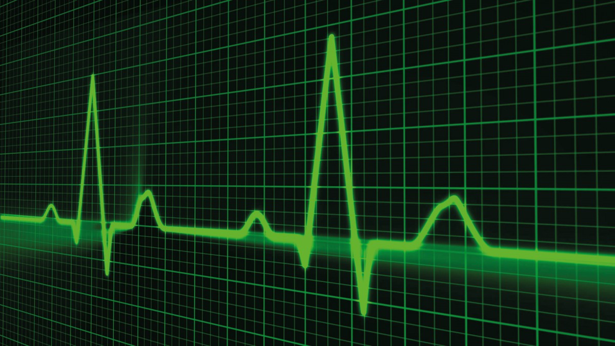 Electrocardiography (ECG).