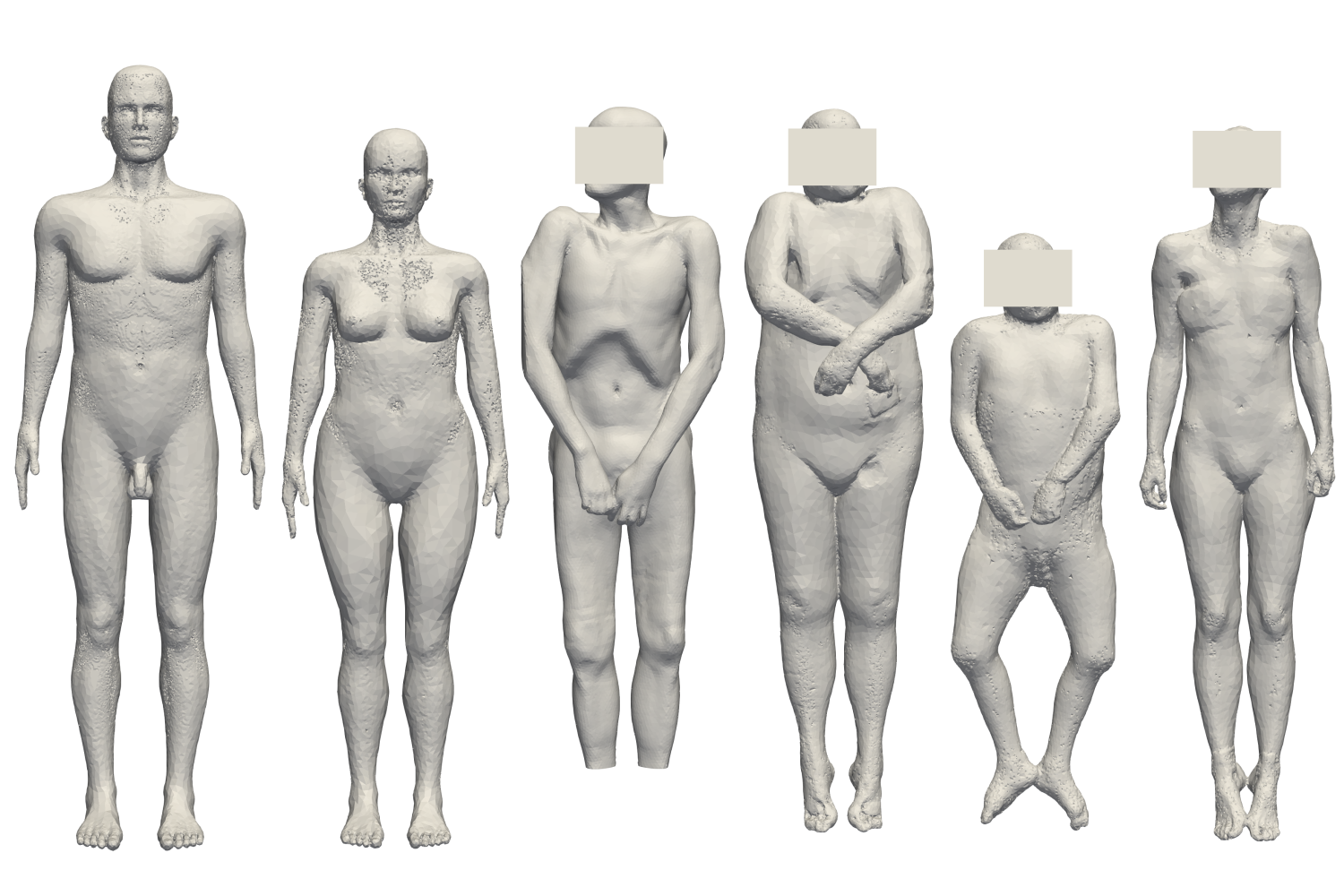 Different 3D meshes obtained from CT scans and CAD design