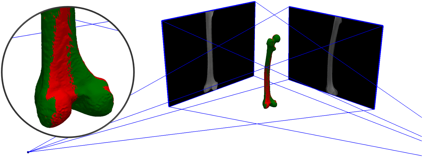 Virtual bi-planar fluoroscopy setup for an in-silico example of 2D-3D registration of a femur bone. Registration solution (red) almost perfectly matches the known target solution (green).