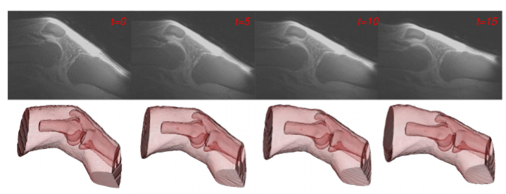 Reconstructed dynamic HR spatial resolution image (top) and dynamic displacement of tissues (bottom) 