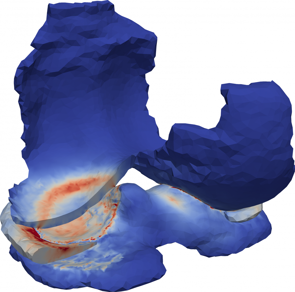 Simulated stress distribution within knee cartilage