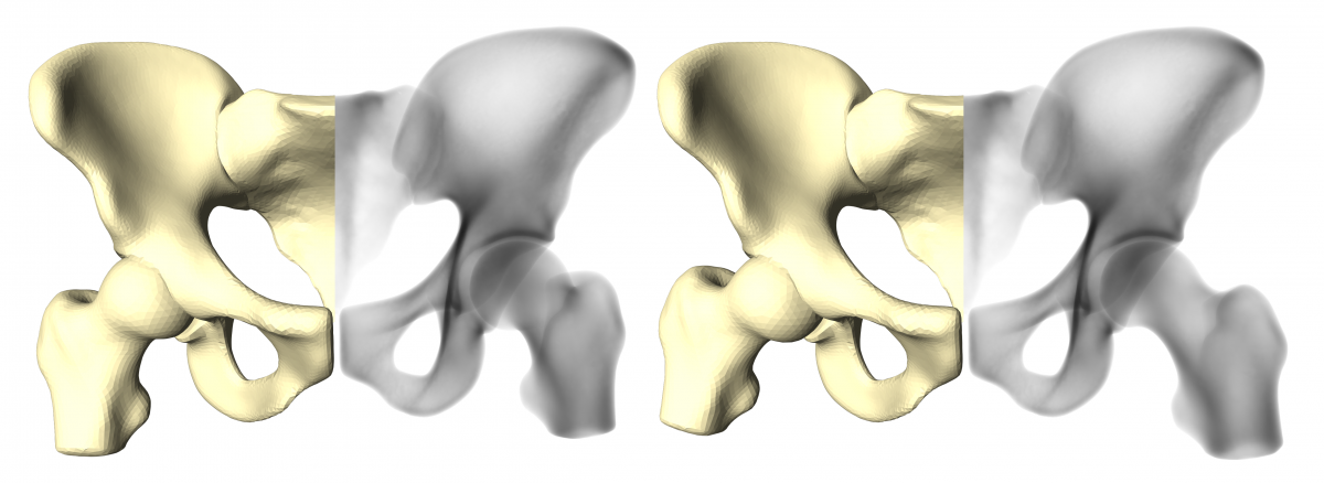 Fig. 3: Articulated Statistical Shape and Intensity Model of the hip