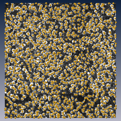 (e) Maximum intensity projection of 3D image containing stained somata and the centroids of the automatically detected somata.