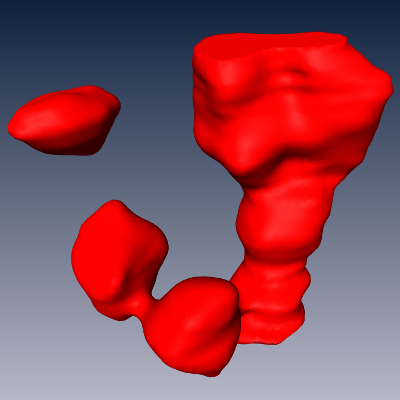 (b) The first step produces a binary segmentation using a sequence of image filters. Shown is a surface resulting from triangulation of the binary image.