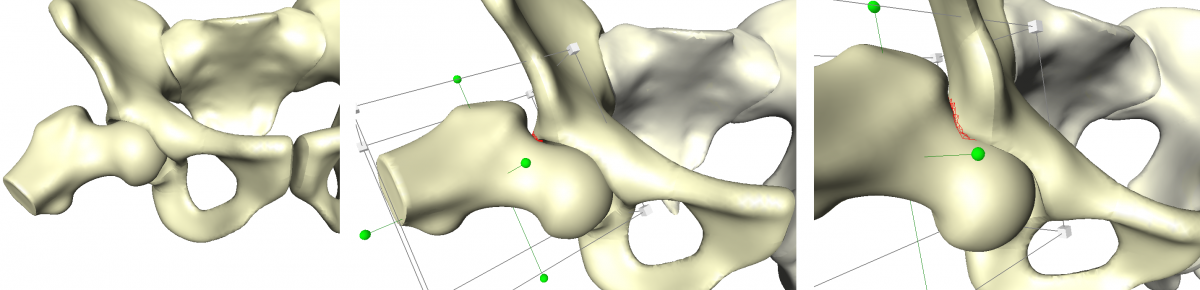 Femur movement with collision detection