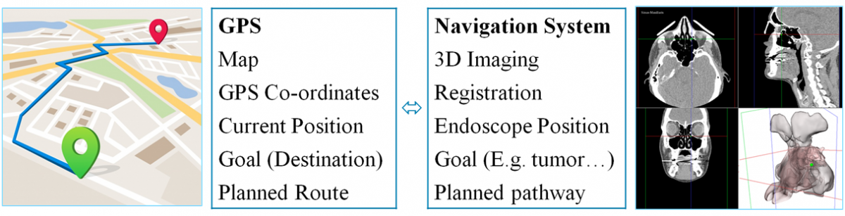 GPS vs. Surgical Navigation