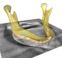 Mandible Segmentation