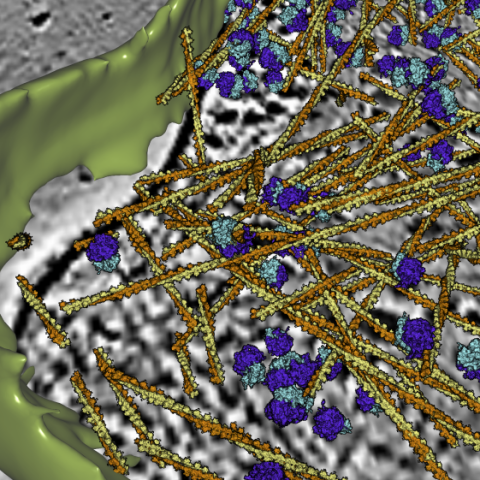 reconstruction of actin filaments, ribosomes and cell membrane from an electron tomogram