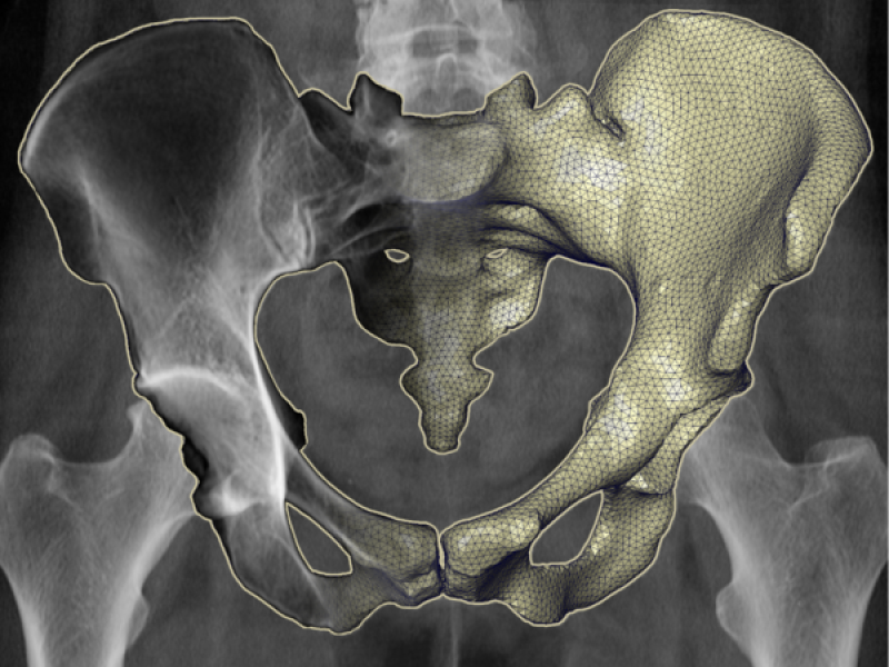 3D Reconstruction from 2D X-ray Images