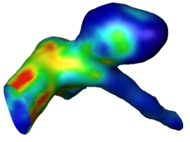 Patient-specific Analysis of the Hemodynamics of Cerebral Aneurysms