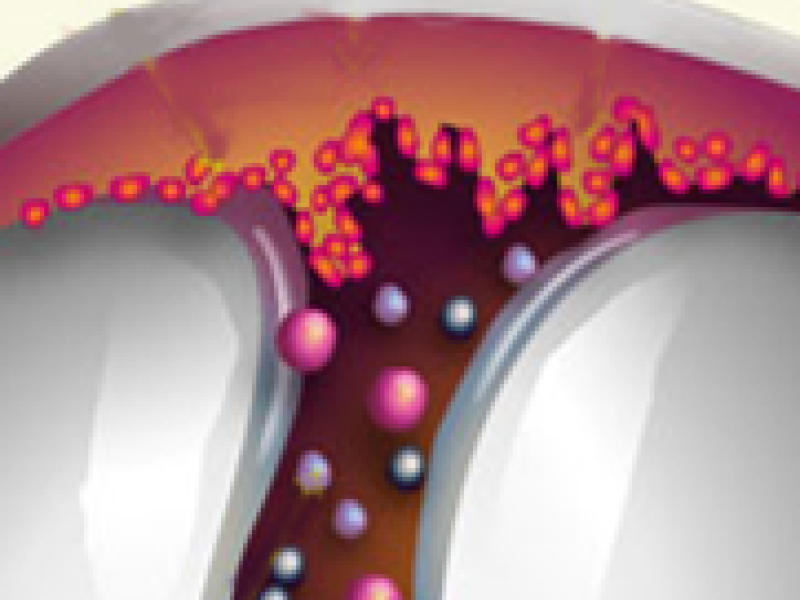 Modelling Inflamed Arthritic Joints