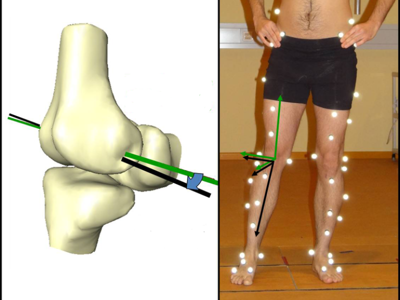 Muskuloskeletal and Functional Analysis