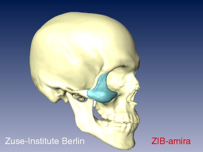 Computational Surgery Planning