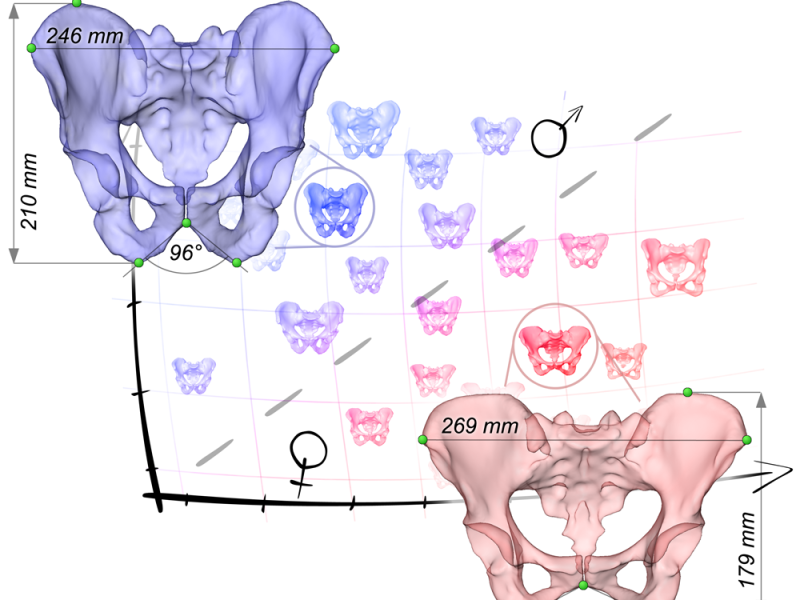 Shape Analysis of the Pelvis