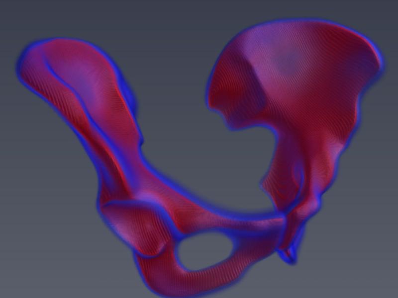 X-ray based Anatomy Reconstruction with Low Radiation Exposure