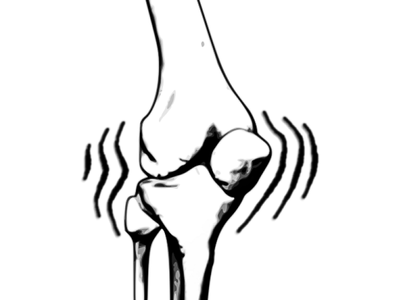 Dynamic Multi-modal Knee Joint Registration