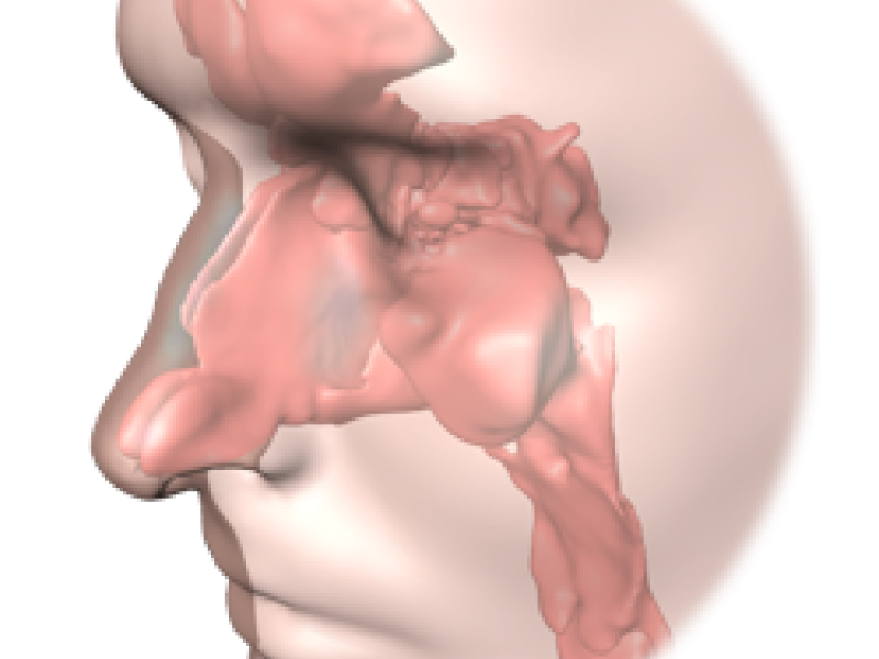 ENT-Surgery under Consideration of Optimal Nasal Air Flow