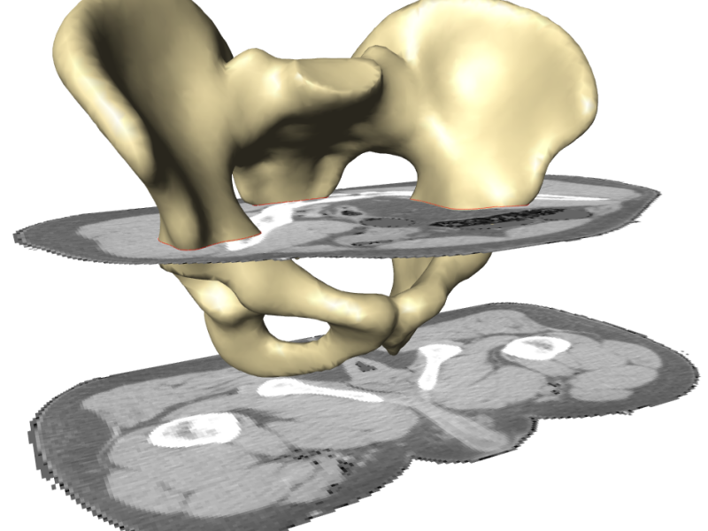 Atlas-based 3D Image Segmentation