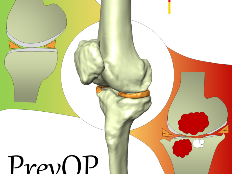 Analysis and quantification of morphological and structural changes in cartilage