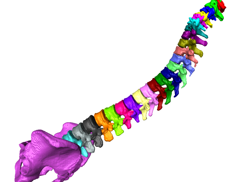 Geometric Analysis of the Human Spine for image-based diagnosis, biomechanical analysis, and neurosurgery
