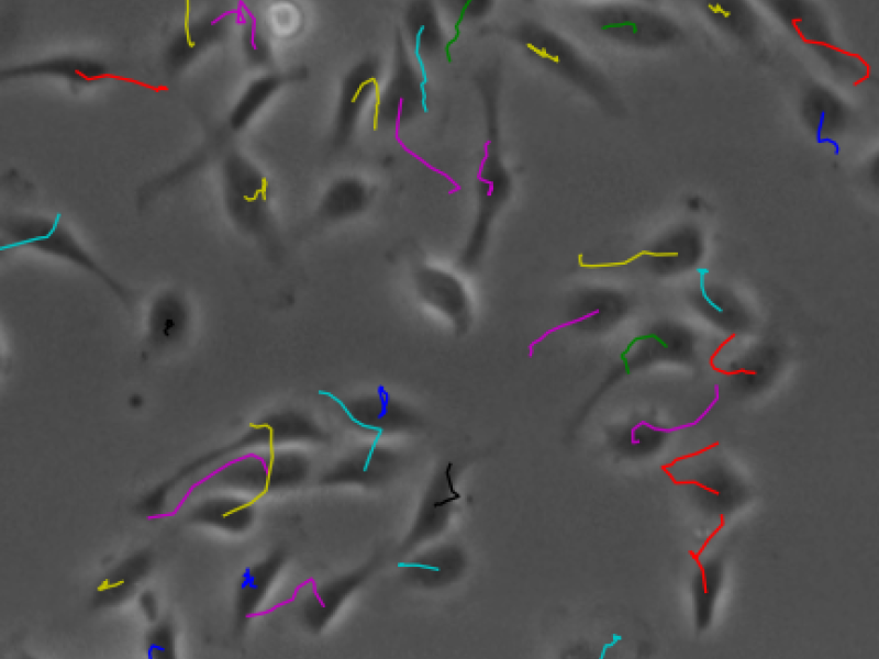 Collaborative Data Analysis for Microscopy