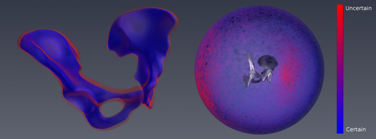 Normal displacement uncertainty computed from the ASSIM parameter covariance. Right: Uncertainty for single XR projection depending on the view angle.