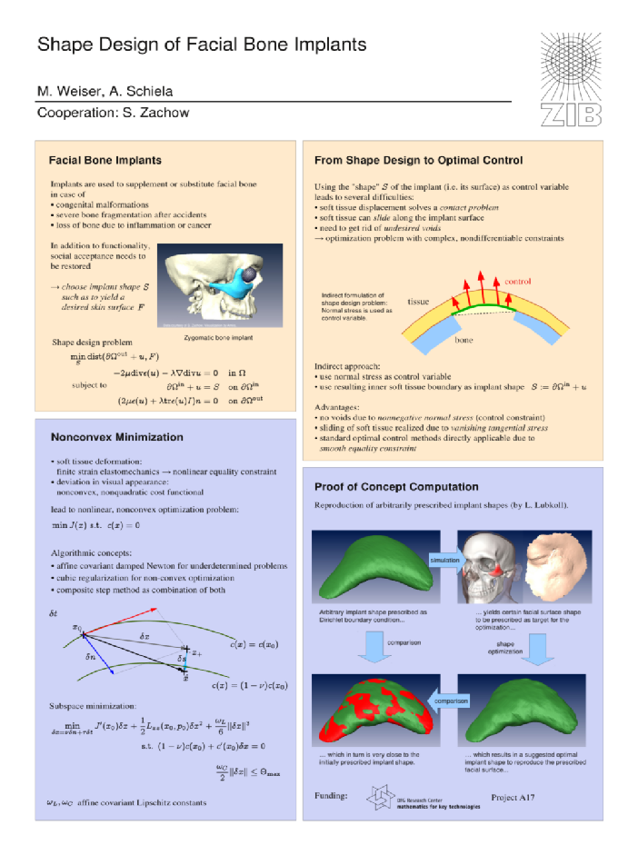 poster displaying work on shape design for facial bone implants